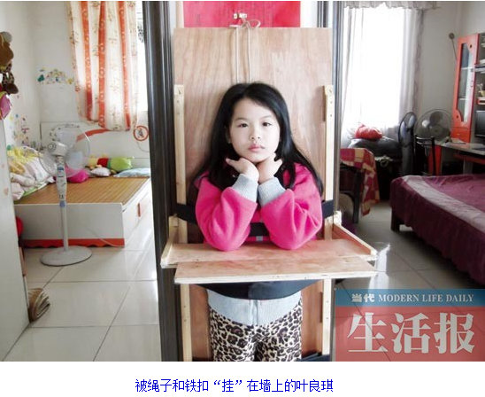 舞蹈受伤频发儿童学舞注意事项