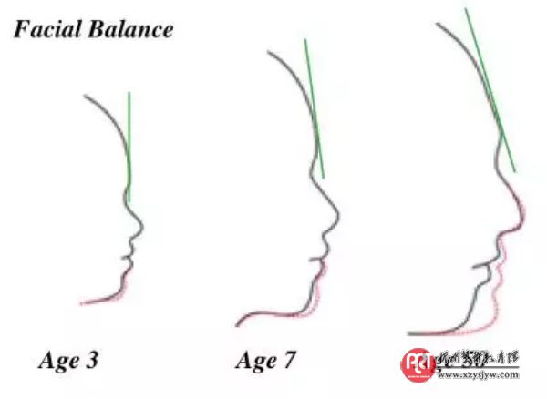 孩子越长越丑,只因一个坏习惯